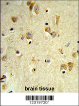 PEX14 Antibody