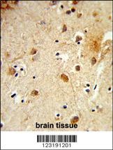 HRIHFB2025 Antibody