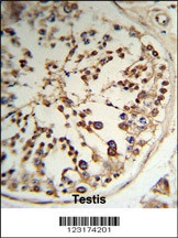 TPK1 Antibody