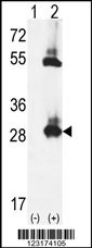 TPK1 Antibody