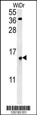 KXD1 Antibody