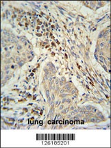 KXD1 Antibody