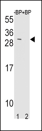 TIMP3 Antibody