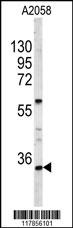 HOXA9 Antibody