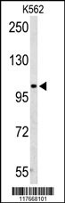 AMPD2 Antibody