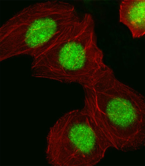 HMGA1 Antibody