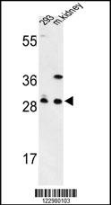 GCLM Antibody