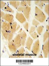 GCLM Antibody