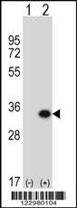 GCLM Antibody