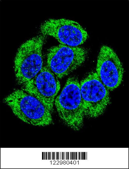 GCLM Antibody