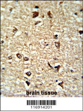 CDC2L6 Antibody