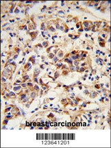 SPRR1B Antibody