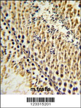 EXTL3 Antibody