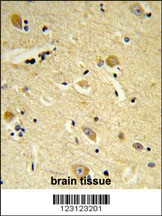 CDIPT Antibody