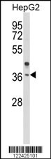 OR2H2 Antibody