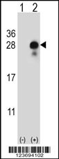 DLK2 Antibody
