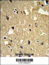 TBB1 Antibody