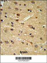 DPP10 Antibody