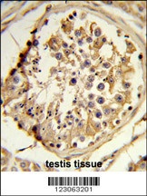 CEP128 Antibody