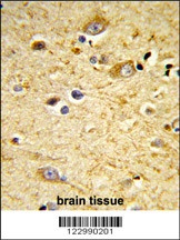 GSTA4 Antibody