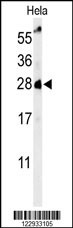 RAB8A Antibody