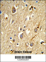 RAB8A Antibody