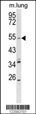 KCNQ1 Antibody