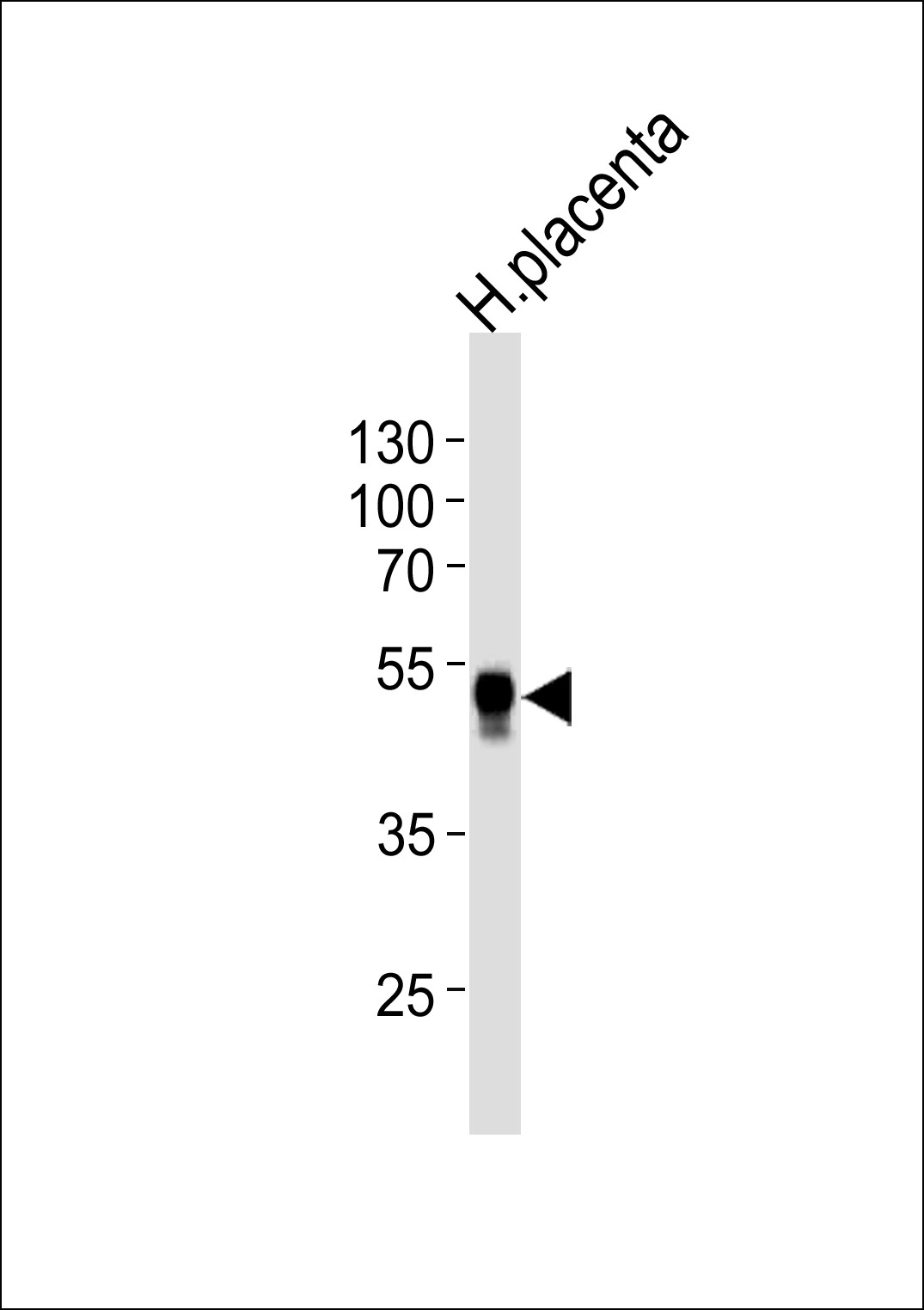 HLA-G Antibody