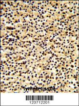 DTX1 Antibody