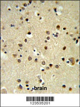 CBX1 Antibody