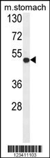 FERMT1 Antibody