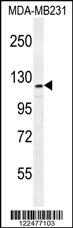 ADAMTS18 Antibody