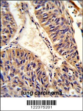 ALG14 Antibody