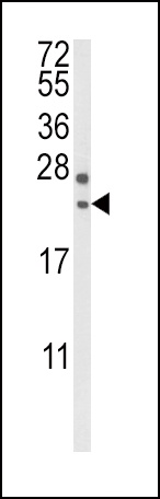 RGS4 Antibody
