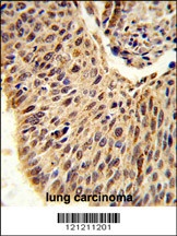 GLIS1 Antibody