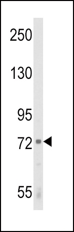 ALOX12 Antibody