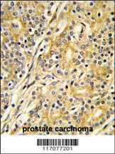 CYP51A1 Antibody