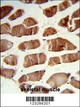 CSRP2BP Antibody