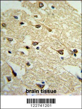 ADCY8 Antibody