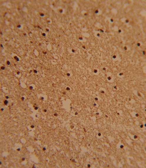 PSMB1 Antibody