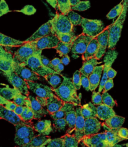 PSMB1 Antibody