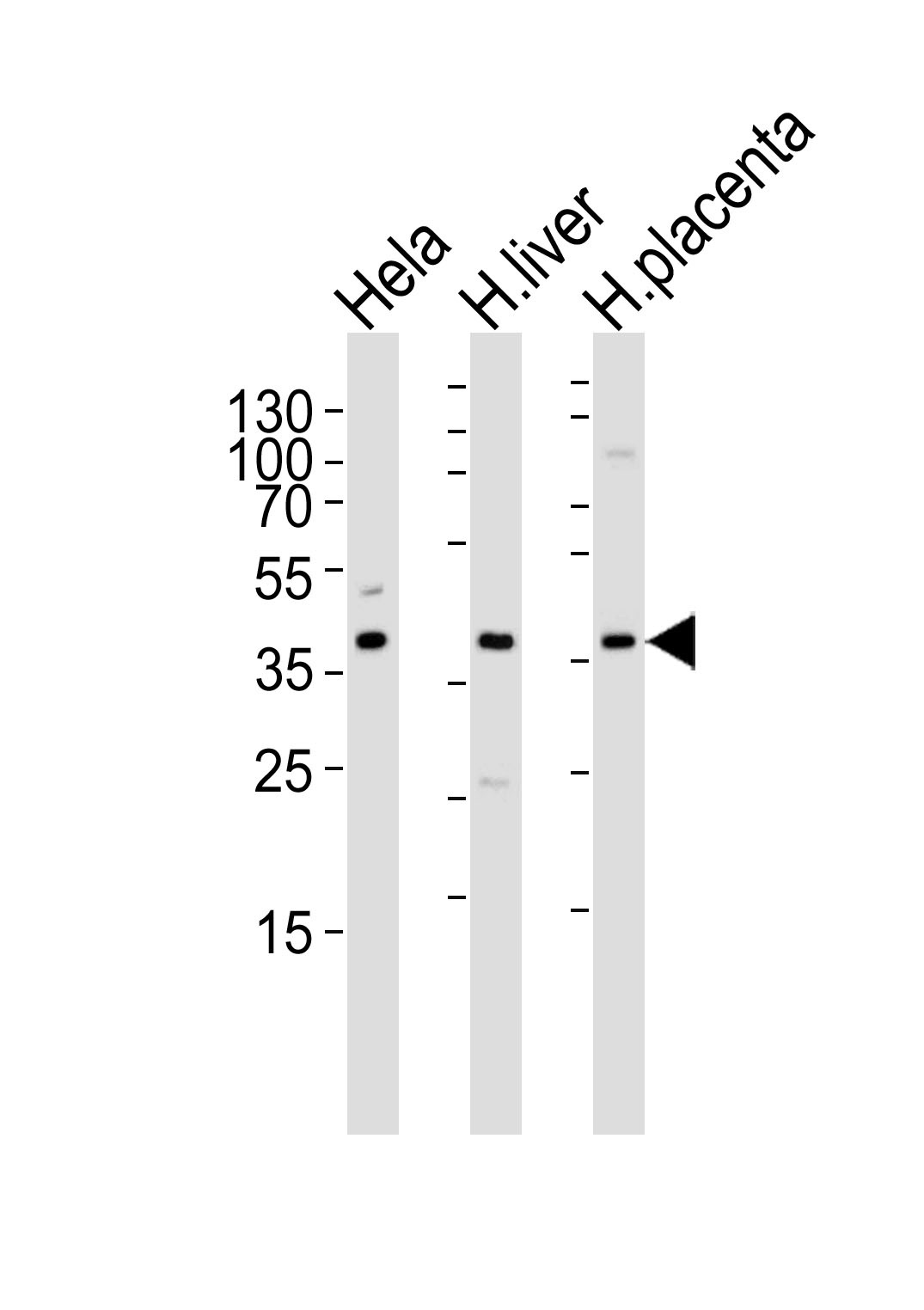 OLR1 Antibody