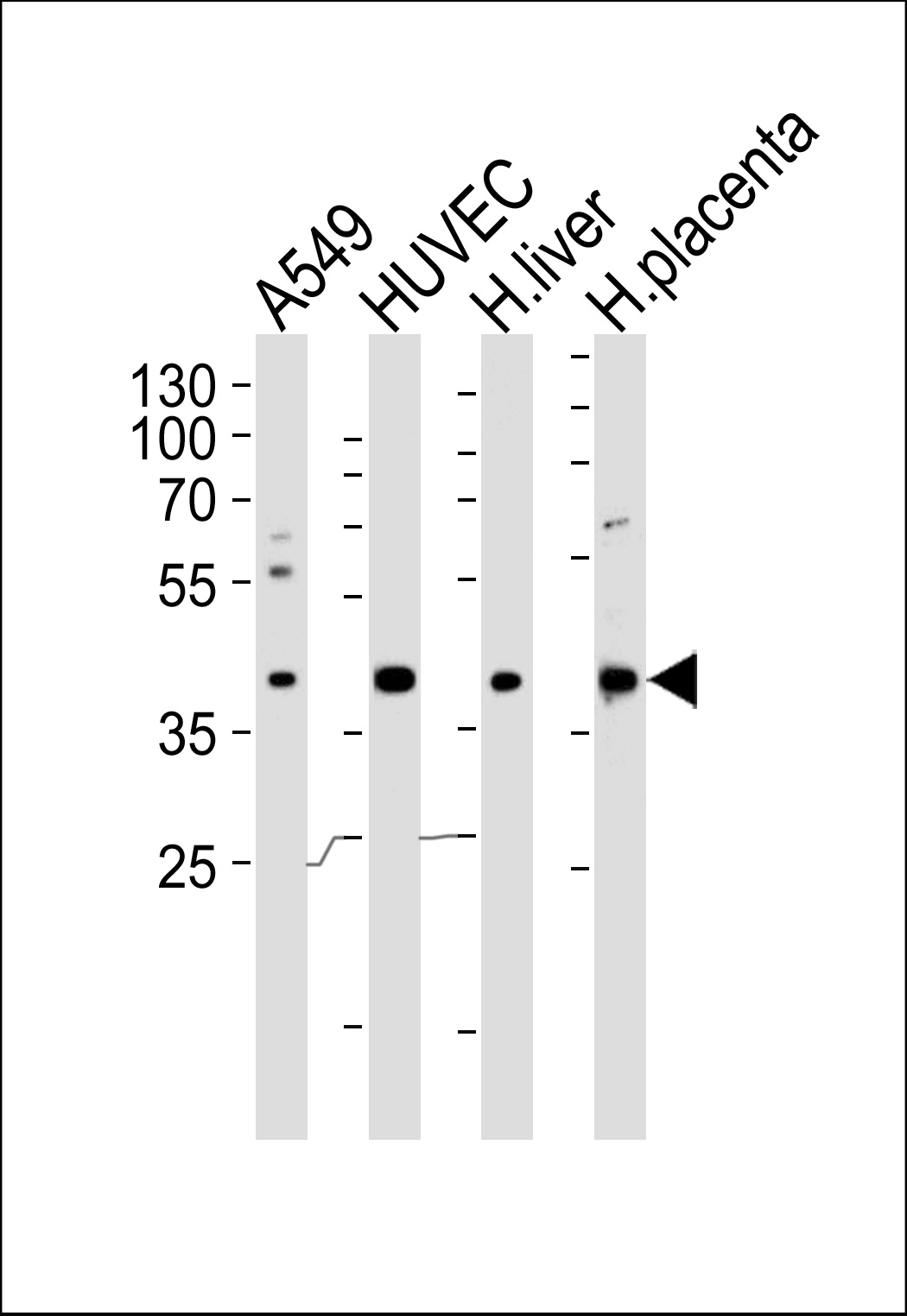 OLR1 Antibody