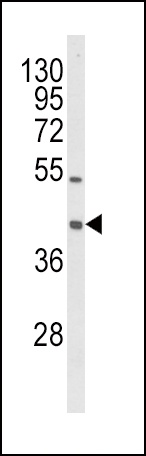 OLR1 Antibody