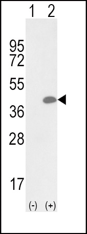 OLR1 Antibody