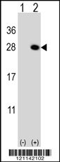 QDPR Antibody