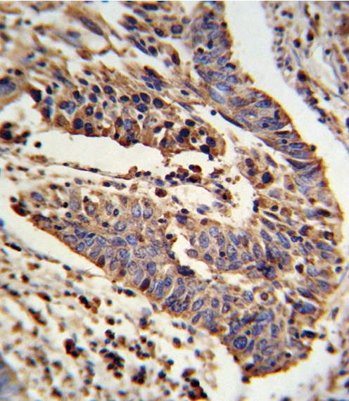 SCNN1A Antibody