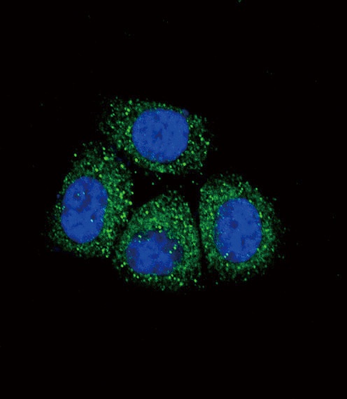 SCNN1A Antibody