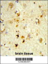 ITGBL1 Antibody