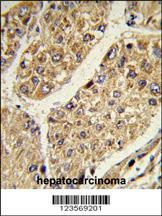 CSGALNACT2 Antibody